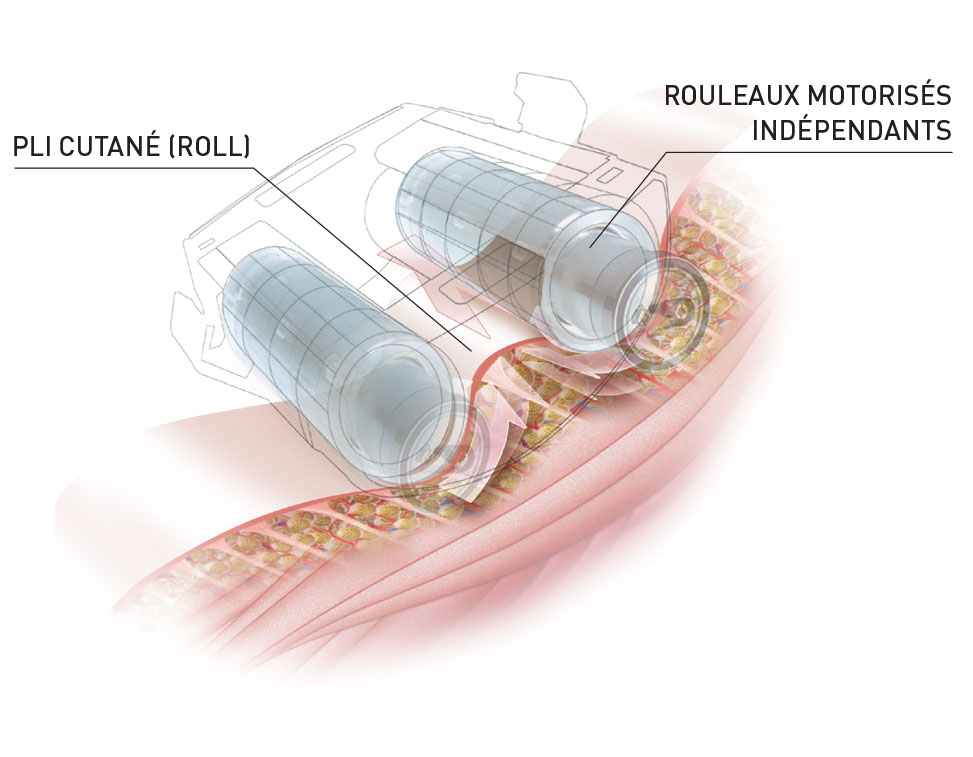 Programme IDEAL : LPG® endermologie corps - L'Escale Pour Soi